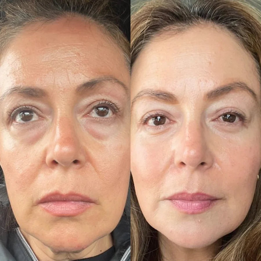 Sensoria Fusion Therapy™