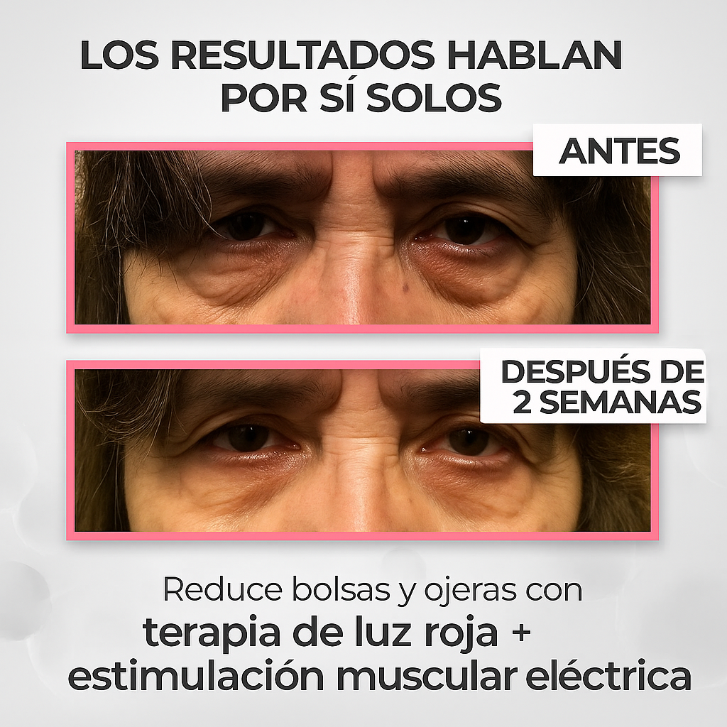 Auralisse® Revitaliza Tu Mirada