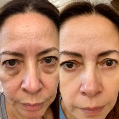 Auralisse® Revitaliza Tu Mirada