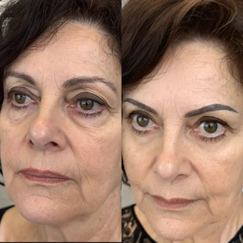 Auralisse® Revitaliza Tu Mirada